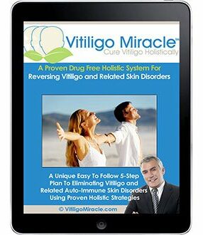 Vitiligo Miracle Review